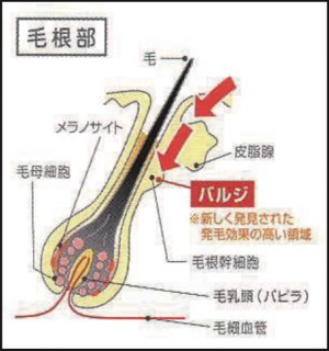 バルジ